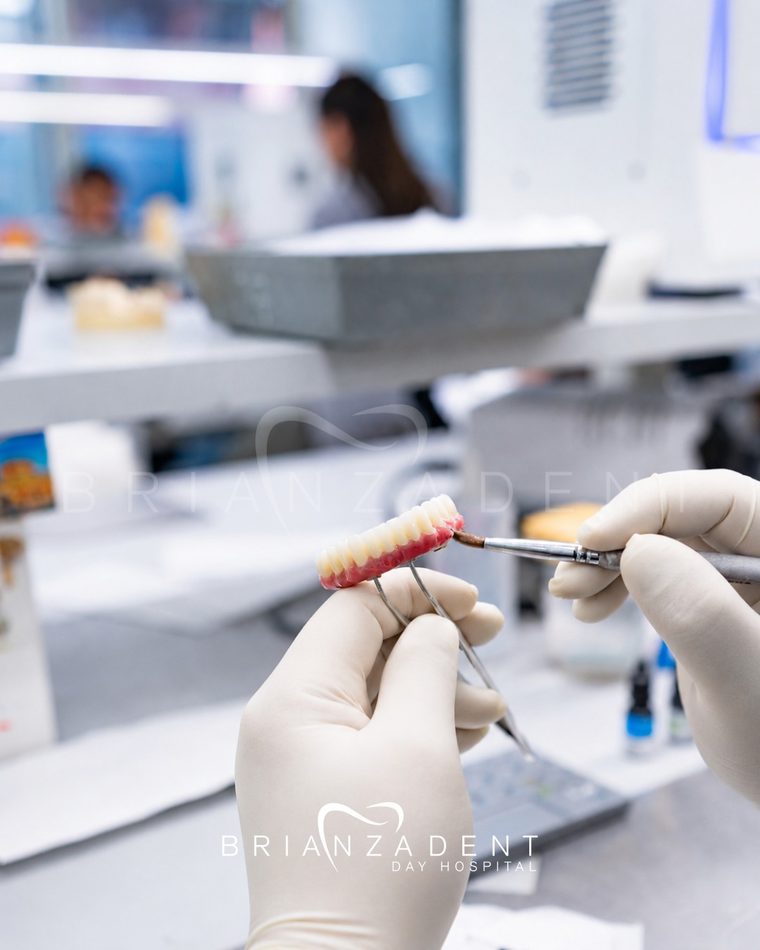 Fotogrametría PIC registrando la posición exacta de varios implantes antes de fabricar el puente definitivo